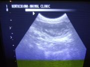 LitterI_ultrasound01.jpg