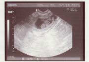 01/07/12-LitterK_Ultrasound1