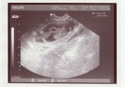 01/07/12-LitterK_Ultrasound1