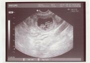 01/07/12-LitterK_Ultrasound1