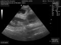 Ultrasound_02.jpg