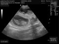 Ultrasound_04.jpg