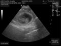 Ultrasound_05.jpg