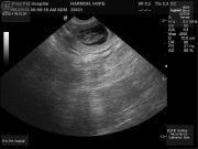 LitterM-ultrasound