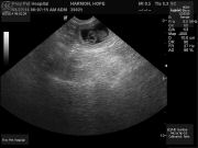 LitterM-ultrasound